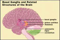 parkinson's disease brain